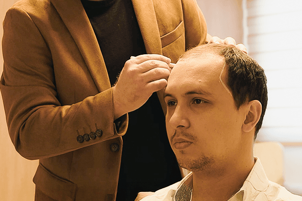 Hair restoration consultation with patient at Sanabria Clinic