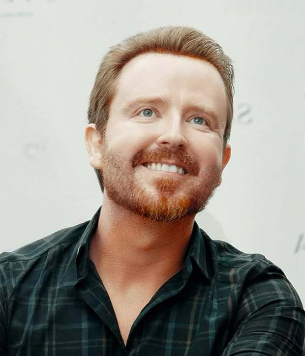 Male patient showing natural hairline restoration after High-Count No-Shave FUE